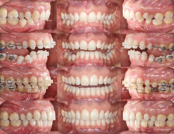 Ortho UNPLUGGED